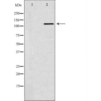 SMARCA5 Antibody - Western blot analysis of Hela whole cell lysates, using SMARCA5 Antibody.