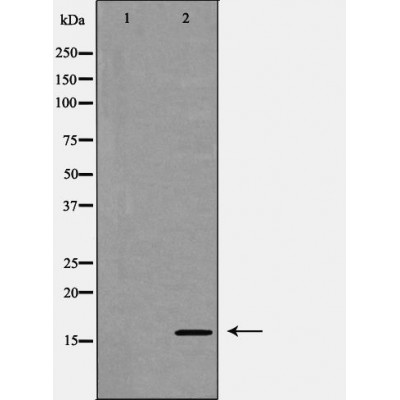 EIF5A1 Antibody - Western blot analysis of Jurkat whole cell lysates, using EIF5A1 Antibody.