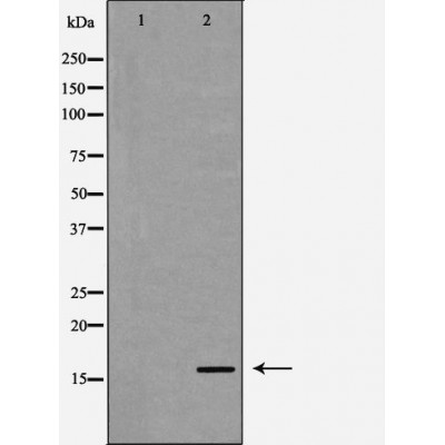 RPS19 Antibody - Western blot analysis of Hela whole cell lysates, using RPS19 Antibody.