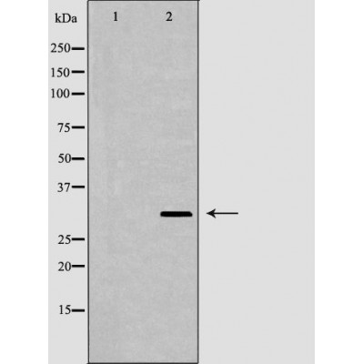 ICAM2 Antibody - Western blot analysis of extracts from Jurkat, using ICAM2 antibody.