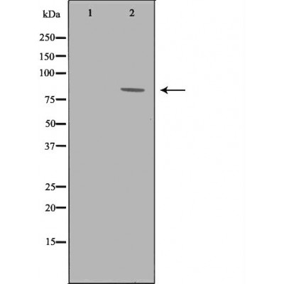 GRK3 Antibody - Western blot analysis of Mouse heart lysates, using ADRBK2 Antibody.