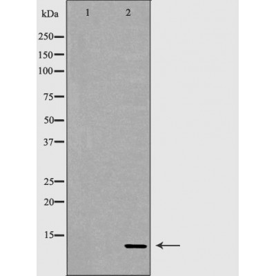 Insulin Antibody - Western blot analysis of extracts from fetal pancreas, using INS antibody.