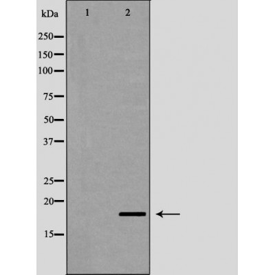 Pin1 Antibody - Western blot analysis of Hela whole cell lysates, using PIN1 Antibody.