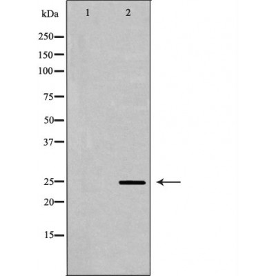 PGP9.5 Antibody - Western blot analysis of Mouse brain lysates, using UCHL1  Antibody.