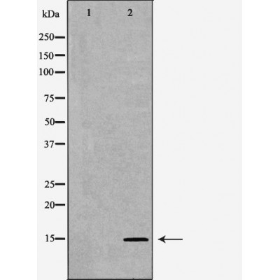 SPINLW1 Antibody - Western blot analysis of Mouse liver tissue lysates, using SPINLW1 Antibody.