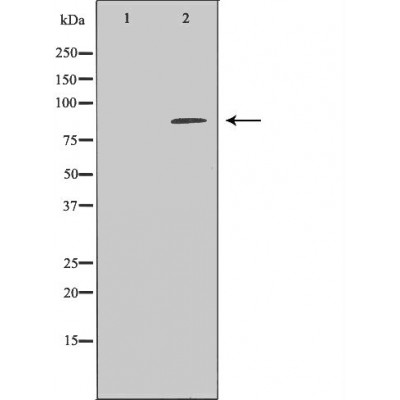 NR3C1 Antibody - Western blot analysis of Hela whole cell lysates, using NR3C1 Antibody.
