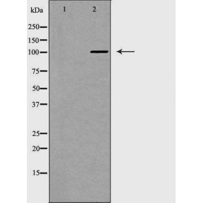 PMS1 Antibody - Western blot analysis of Hela whole cell lysates, using PMS1 Antibody.