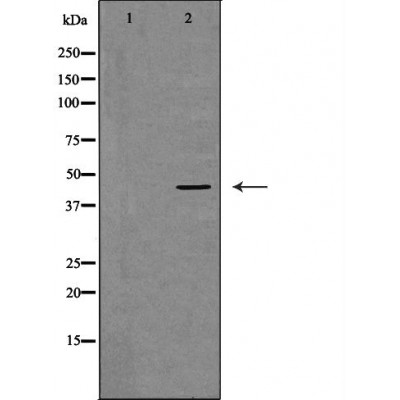 p50 Dynamitin Antibody - Western blot analysis of MCF7 cell lysates, using DCTN2 Antibody.