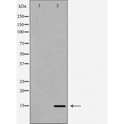 Histone H3R2me2s Antibody - Western blot analysis of extracts from HeLa  using H3R2me2s antibody.