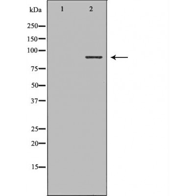 Integrin beta 5 Antibody - Western blot analysis of Hela cell lysates, using ITGB5 Antibody.