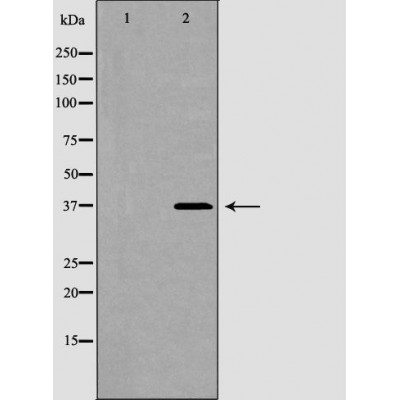 GJA4 Antibody - Western blot analysis of Hela whole cell lysates, using GJA4 Antibody.