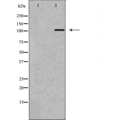 GEF H1 Antibody - Western blot analysis of Hela whole cell lysates, using ARHGEF2 Antibody.