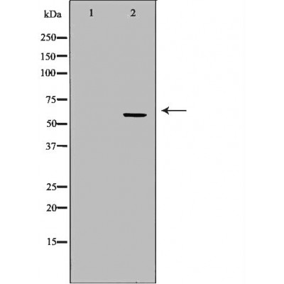 MAP2 Antibody - Western blot analysis of Mouse brain lysates, using MAP2  Antibody.