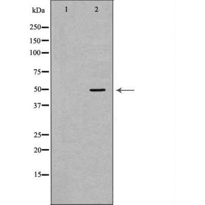 Cytokeratin 15 Antibody - Western blot analysis of extracts from Mouse thymus tissue lysates, using KRT15antibody.