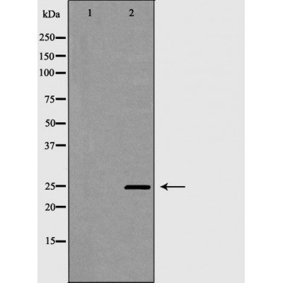 PDCD10 Antibody - Western blot analysis of Hela whole cell lysates, using PDCD10 Antibody.