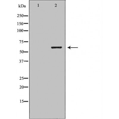 PSMD3 Antibody - Western blot analysis of Hela whole cell lysates, using PSMD3 Antibody.