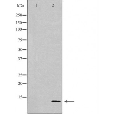 Parvalbumin Antibody - Western blot analysis of extracts from Mouse fetal brain, using PVALB antibody.
