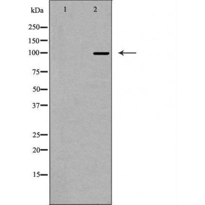 EIF4G2 Antibody - Western blot analysis of Hela whole cell lysates, using EIF4G2 Antibody.