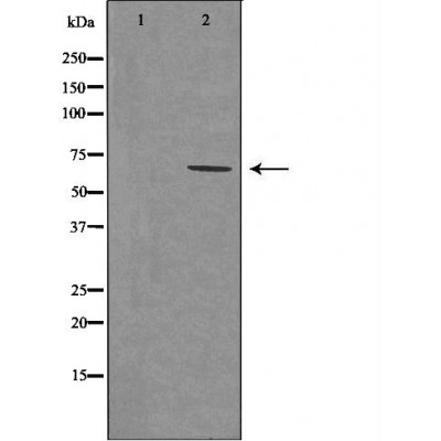 GAD1 Antibody - Western blot analysis of extracts from fetal brain, using GAD1antibody.