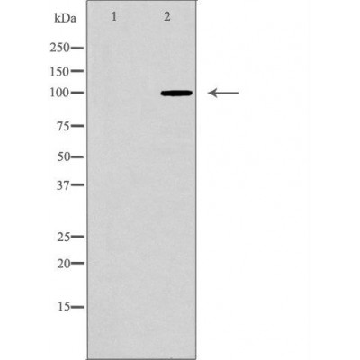 mGluR8 Antibody - Western blot analysis of extracts from mouse brain tissue, using GRM8antibody.