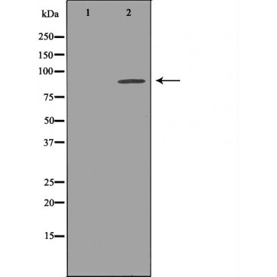 KCNH2 Antibody - Western blot analysis of extracts from Mouse brain tissue lysates, using KCNH2antibody.