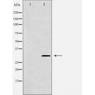IL-2RA/CD25 Antibody - Western blot analysis of extracts from A549 lysates, using IL2RA antibody.