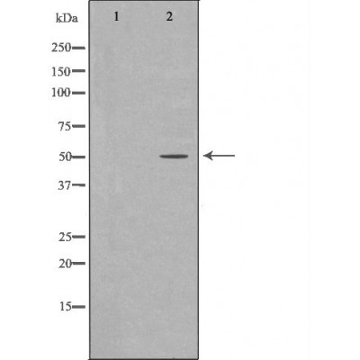 KLF5 Antibody - Western blot analysis of Hela whole cell lysates, using KLF5  Antibody.