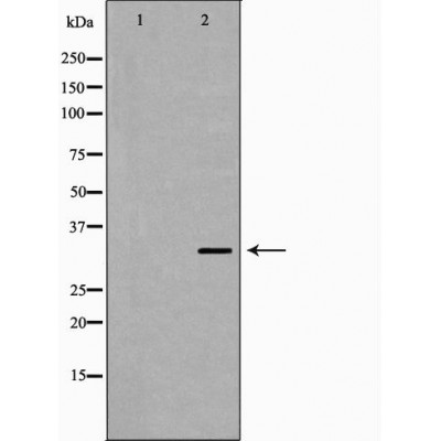 MC2R Antibody - Western blot analysis of extracts from 293 lysates, using MC2R antibody.