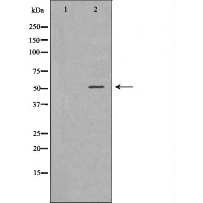 SLC16A1 Antibody - Western blot analysis of extracts from Mouse seminoma tissue lysates, using SLC16A1antibody.