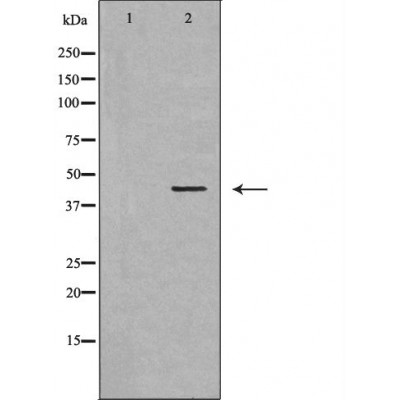 TCF7 Antibody - Western blot analysis of Mouse kidney lysates, using TCF7  Antibody.