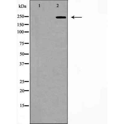NOTCH3 Antibody - Western blot analysis of extracts from human colon cancer tissue lysates, using NOTCH3 antibody.