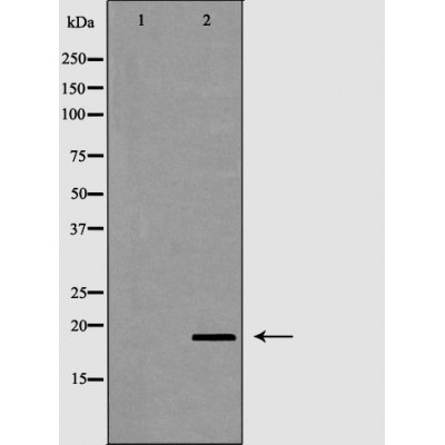 PTN Antibody - Western blot analysis of extracts from human coloncancer , using PTN antibody.