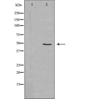 CSF2RA Antibody - Western blot analysis of extracts from Jurkat , using CSF2RA antibody.