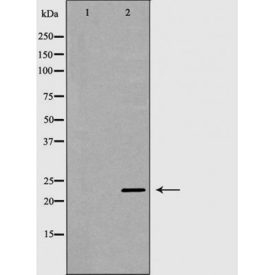 LCN2 Antibody - Western blot analysis of extracts from mouse liver cancer tissue lysates, using LCN2 antibody.