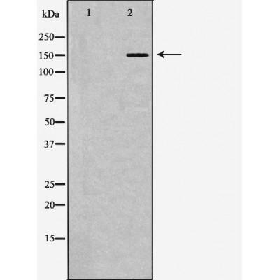 MSH6 Antibody - Western blot analysis of extracts from K562 , using MSH6antibody.