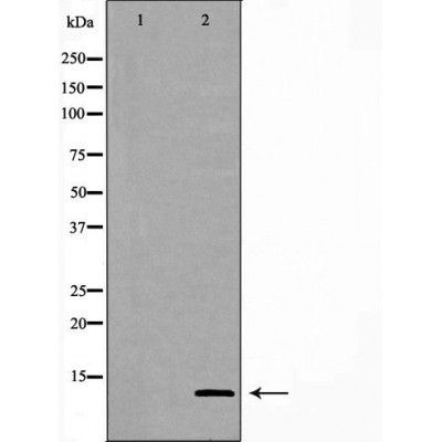 GHRH Antibody - Western blot analysis of Hela cell lysates, using GHRH Antibody.