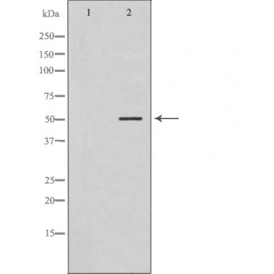 NEK2 Antibody - Western blot analysis of LoVo cell lysates, using NEK2 Antibody.