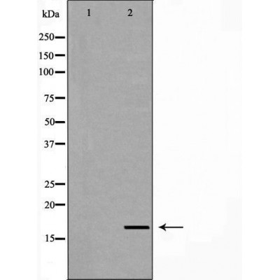 Myoglobin Antibody - Western blot analysis of Hepg2 whole cell lysates, using MB Antibody.