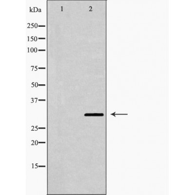 Otx2 Antibody - Western blot analysis of extracts from A673 , using OTX2 antibody.