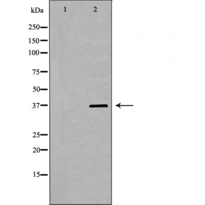 PSRC1 Antibody - Western blot analysis of Hela whole cell lysates, using PSRC1 Antibody.
