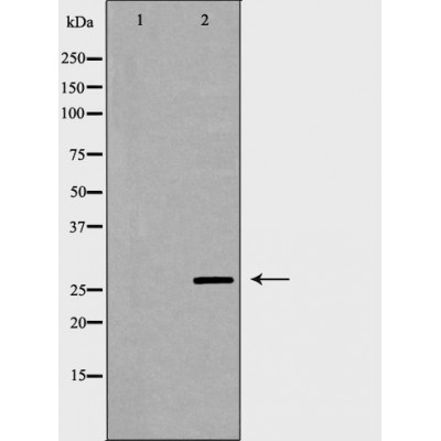 IL27A Antibody - Western blot analysis of Mouse lung tissue lysates, using IL27 Antibody.