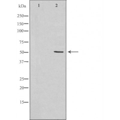 Hemopexin Antibody - Western blot analysis of Hela cell lysates, using HPX Antibody.