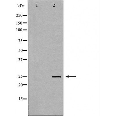 Thymidine Kinase 1/TK1 Antibody - Western blot analysis of Hela whole cell lysates, using TK1 Antibody.