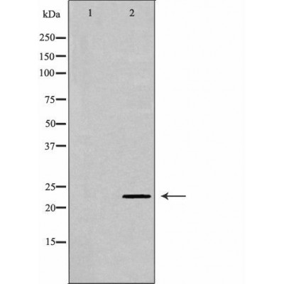RAB6A Antibody - Western blot analysis of Hela whole cell lysates, using RAB6A Antibody.