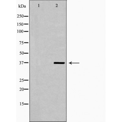 LSP1 Antibody - Western blot analysis of LoVo cell lysates, using LSP1 Antibody.