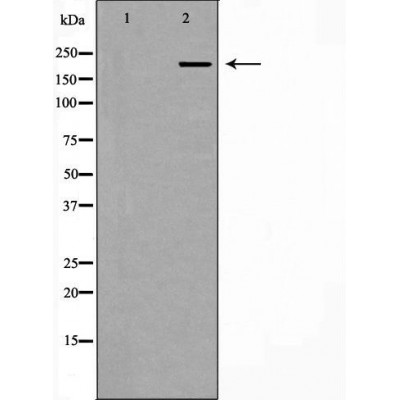 PCM1 Antibody - Western blot analysis of Hela whole cell lysates, using PCM1 Antibody.