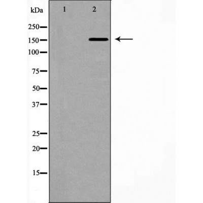 ROCK2 Antibody - Western blot analysis of Hela whole cell lysates, using ROCK2 Antibody.