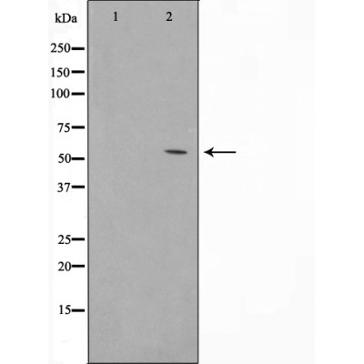BMP5 Antibody - Western blot analysis of BMP5 expression in HUVEC cells,The lane on the left was treated with the antigen-specific peptide.