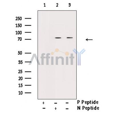 Phospho-C-RAF (Ser296) Antibody - Western blot analysis of Phospho-C-RAF (Ser296) Antibody expression in PMA treated 293 cells lysates.