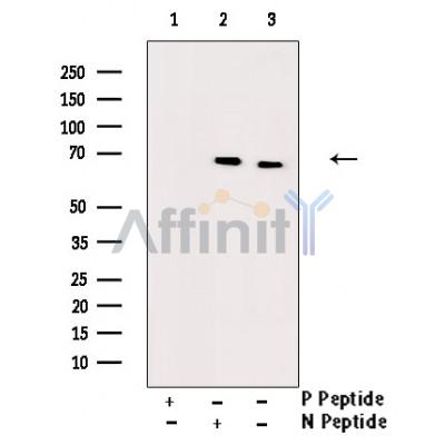 Phospho-CDC25B (Ser353) Antibody - Western blot analysis of Phospho-CDC25B (Ser353) Antibody expression in etoposide treated COS7 cells lysates.